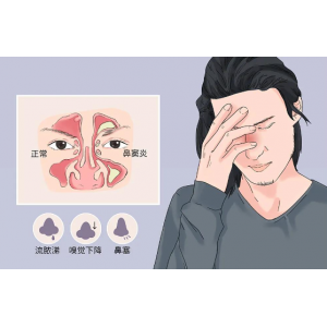 為什么感冒容易導(dǎo)致鼻竇炎，鼻竇炎該如何預(yù)防？