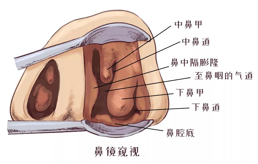 鼻甲肥大引起的呼吸困難怎么辦？(圖2)