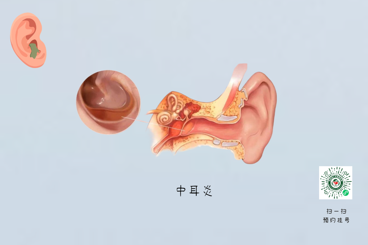 手術(shù)沒做干凈，術(shù)后3年顱內(nèi)竟發(fā)現(xiàn)巨大膽脂瘤！(圖4)