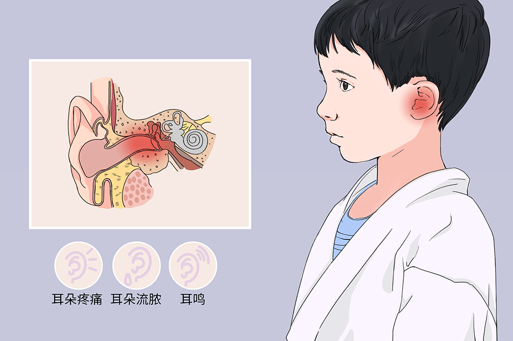 中耳炎雖小，但其危害不容小覷！(圖1)