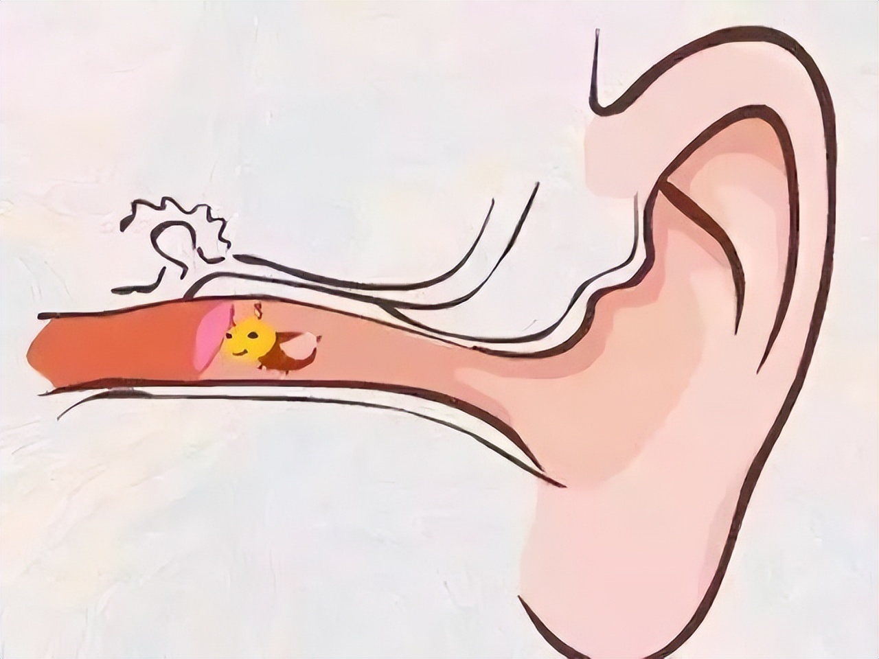 聽力下降絕非小事，若不及時(shí)干預(yù)，嚴(yán)重會(huì)導(dǎo)致耳聾(圖1)