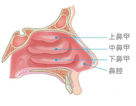 鼻甲肥大會引起面部結(jié)構(gòu)變化，還會導致眼袋、黑眼圈？(圖1)