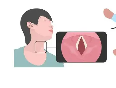 耳鼻喉分享：嘶啞聲不一定是上火，要警惕這些疾??！(圖3)
