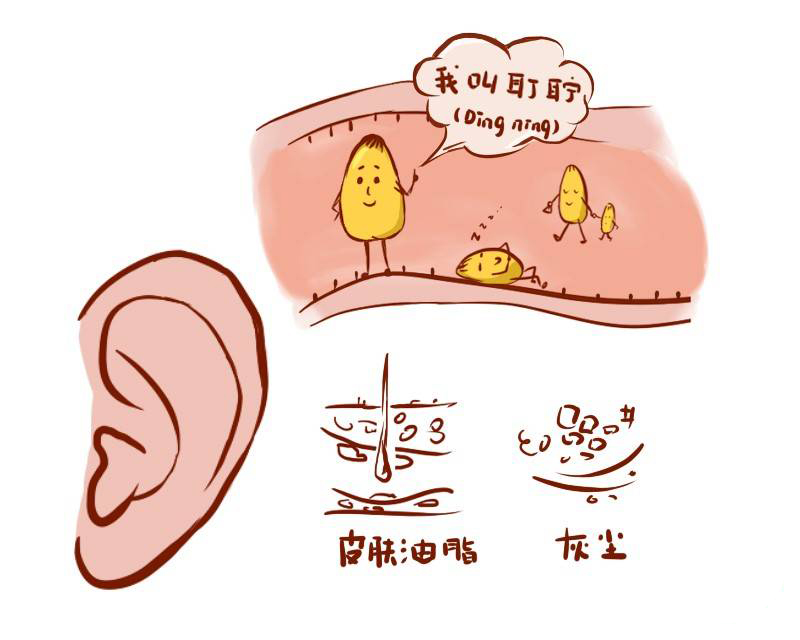關(guān)于中耳炎的5個(gè)常見(jiàn)問(wèn)題，你一定要知道！(圖2)