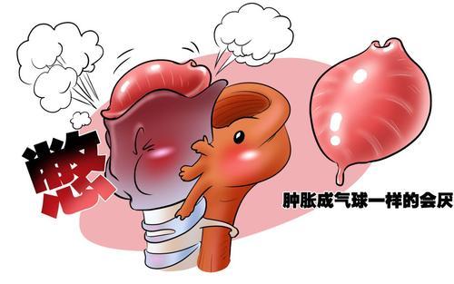 會(huì)厭囊腫并非小毛病，嚴(yán)重會(huì)引起窒息？(圖1)