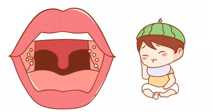 切除扁桃體會對身體產(chǎn)生危害嗎？(圖3)