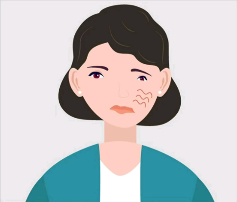 中耳炎會(huì)引起面癱，是真的嗎？(圖3)