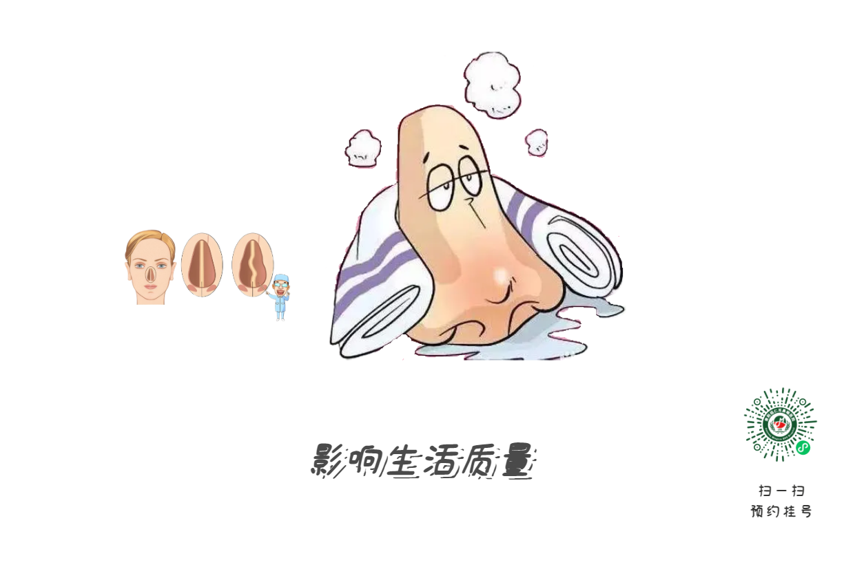鼻塞、流涕、打噴嚏，是鼻炎引起的？注意可能是鼻中隔偏曲！(圖2)