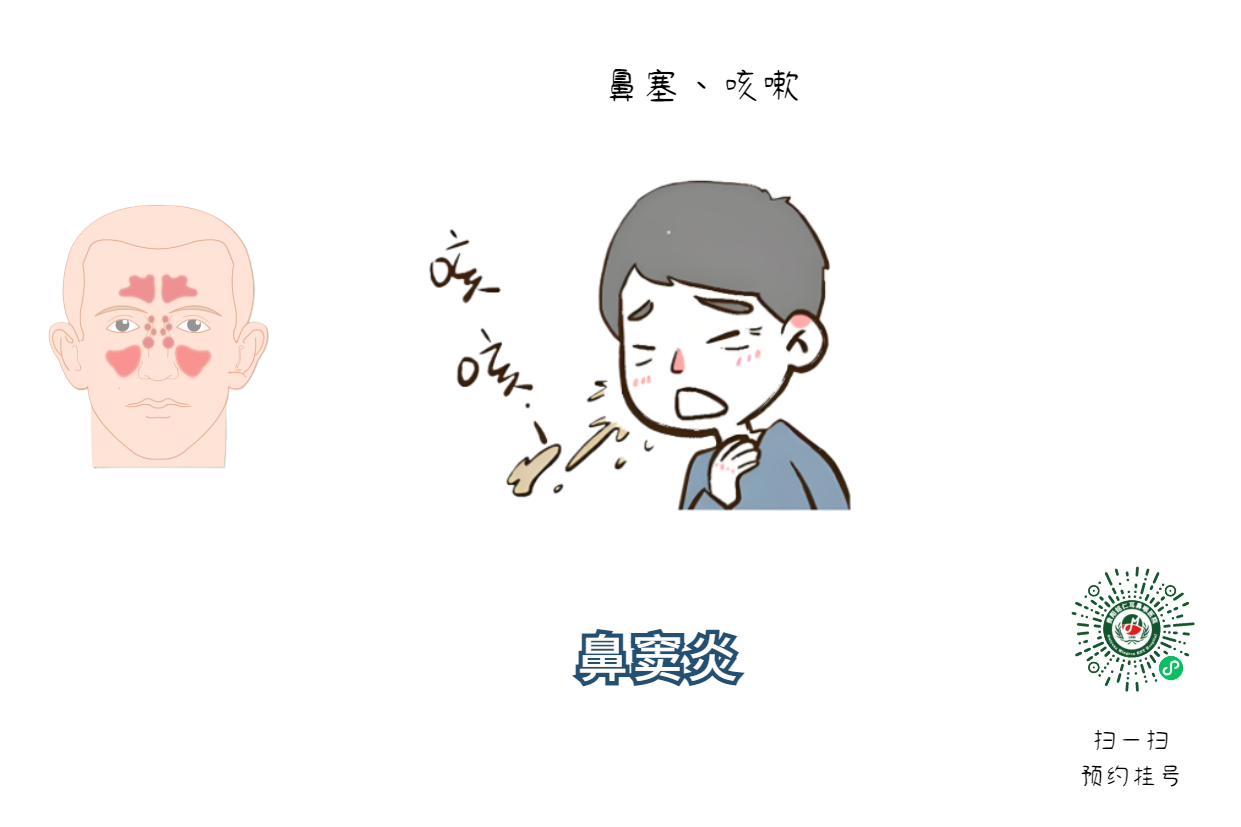 鼻炎、鼻竇炎傻傻分不清，兩者該如何區(qū)分？(圖2)
