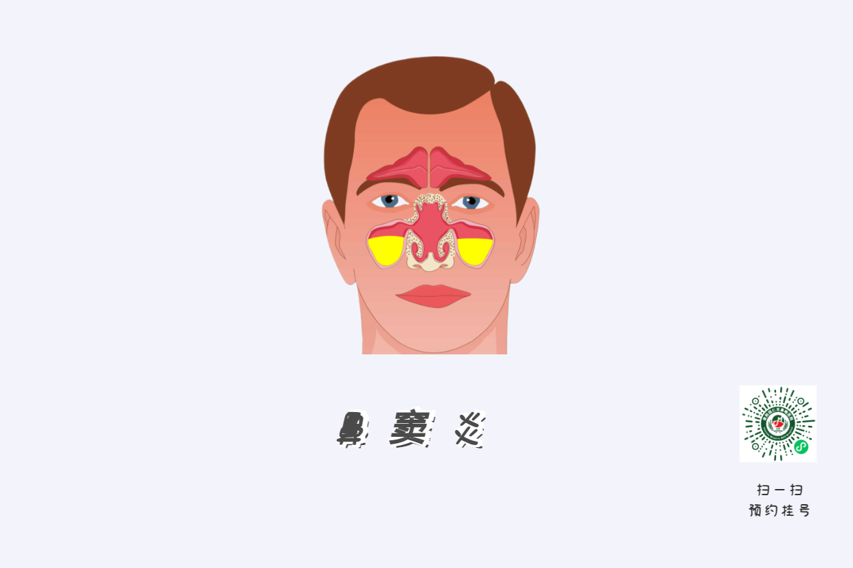鼻竇炎頭痛有特點！這個位置痛要當(dāng)心(圖1)