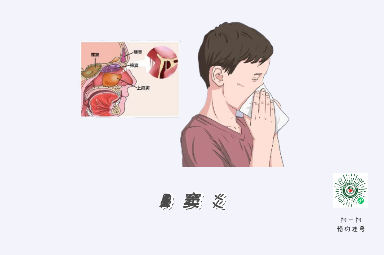 鼻竇炎頭痛有特點！這個位置痛要當(dāng)心(圖3)