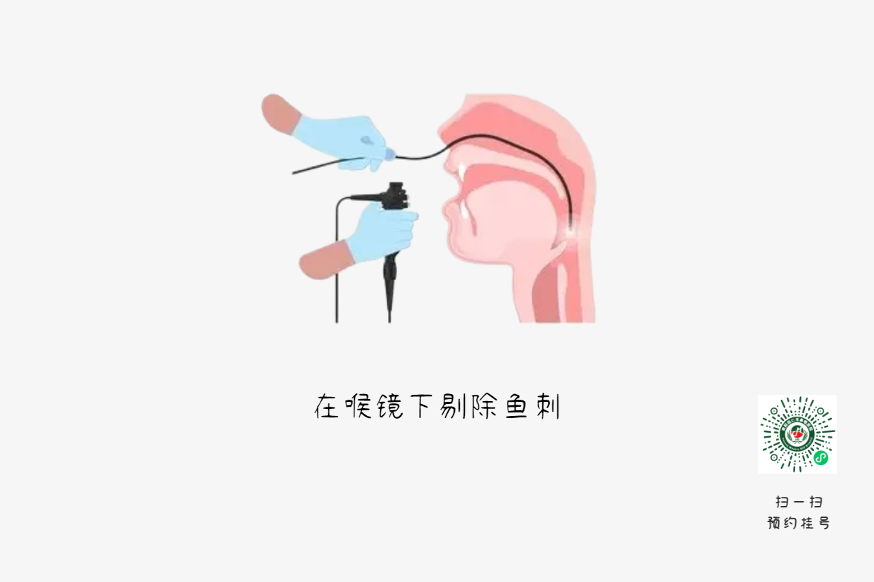 喉嚨卡魚刺？喝醋吞飯都是致命錯(cuò)誤(圖2)
