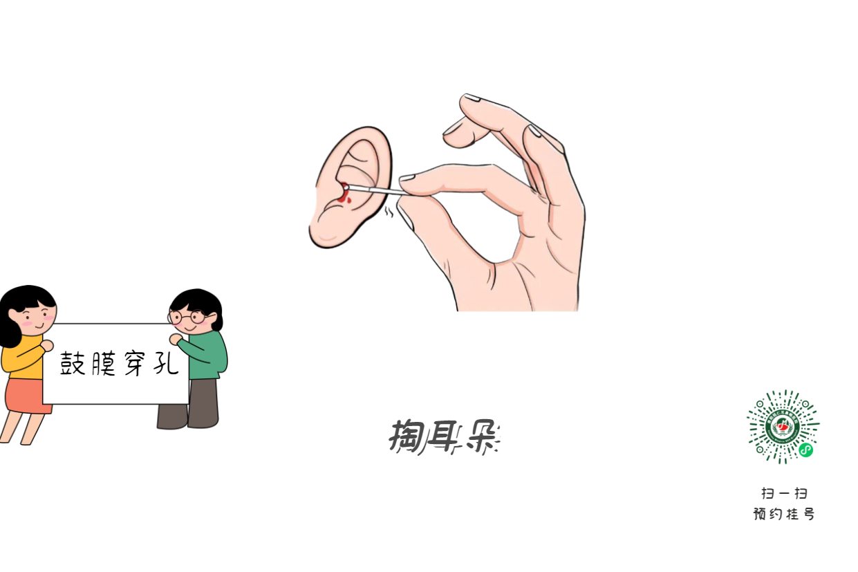 掏耳朵竟致顱內(nèi)感染？這5個習慣快改掉(圖1)