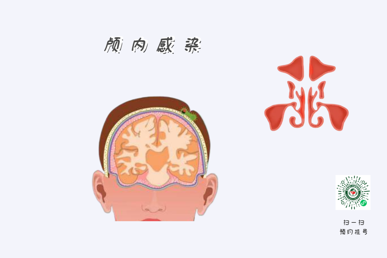 為什么患上鼻竇炎，會使孩子學習成績下降？(圖3)