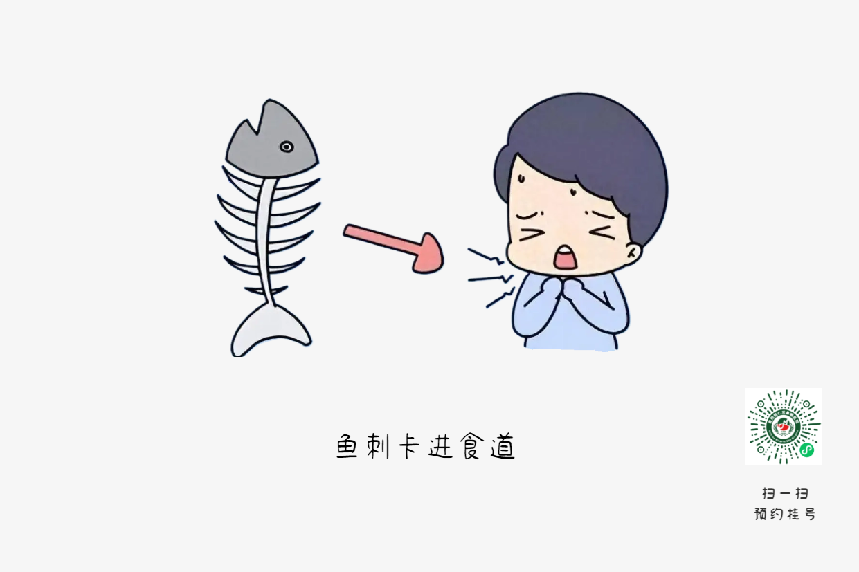 魚刺卡喉時，你的“土方法”可能讓情況更危險(圖1)
