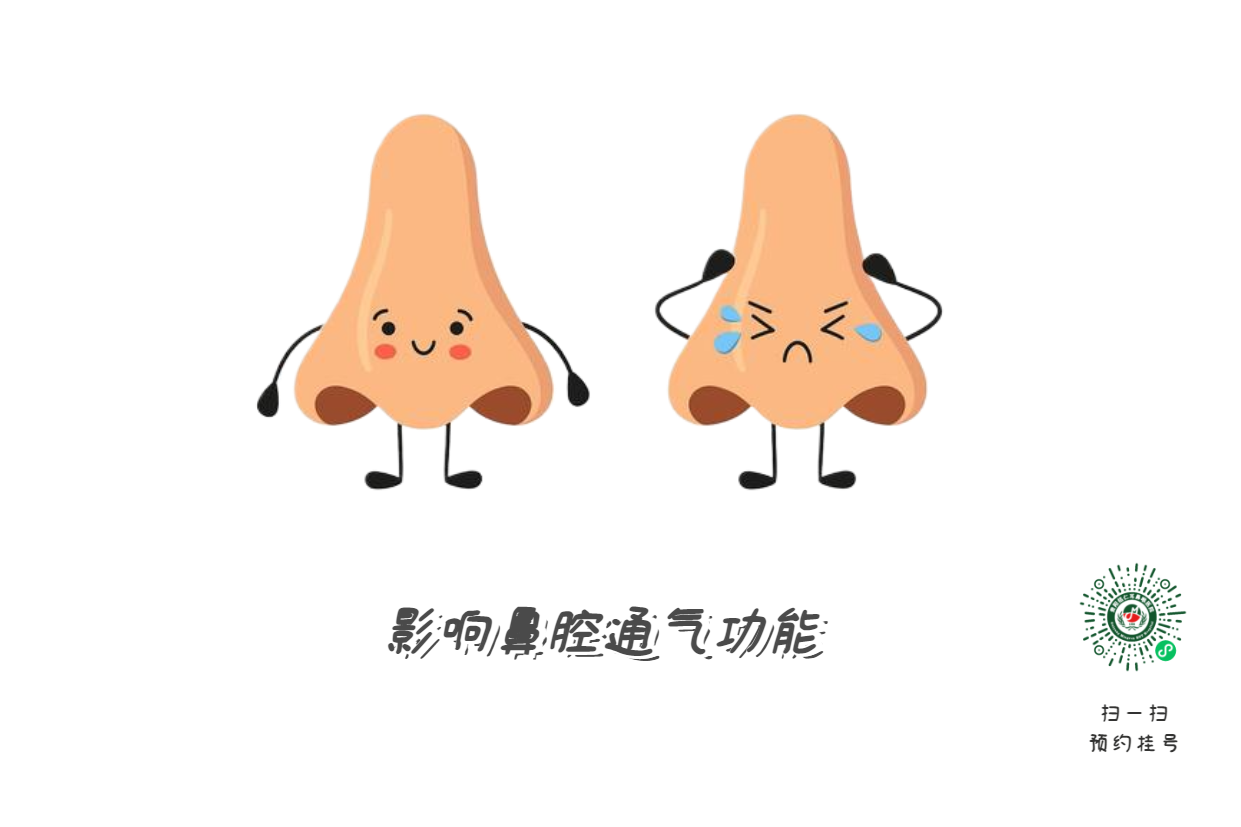 鼻中隔偏曲必須手術(shù)？符合這標(biāo)準(zhǔn)再?zèng)Q定(圖2)