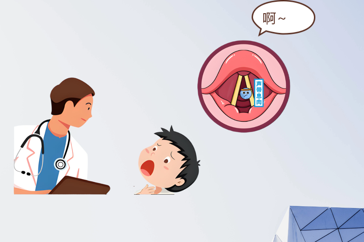 長期清嗓子？可能是聲帶息肉早期信號(圖2)