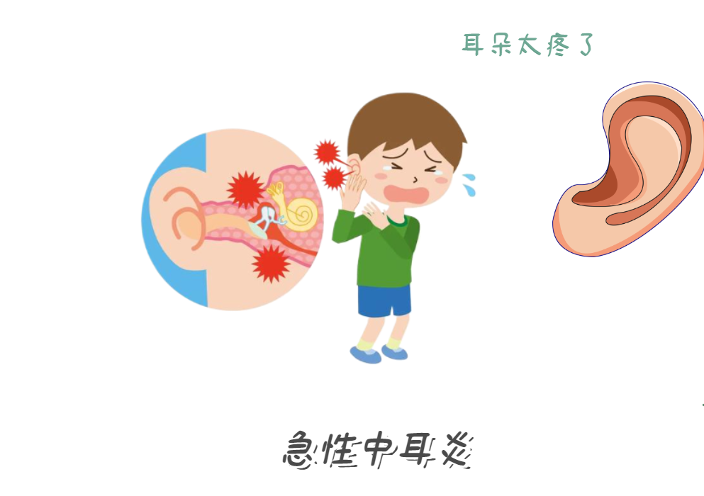 耳朵痛到睡不著？急性中耳炎急救法！(圖1)