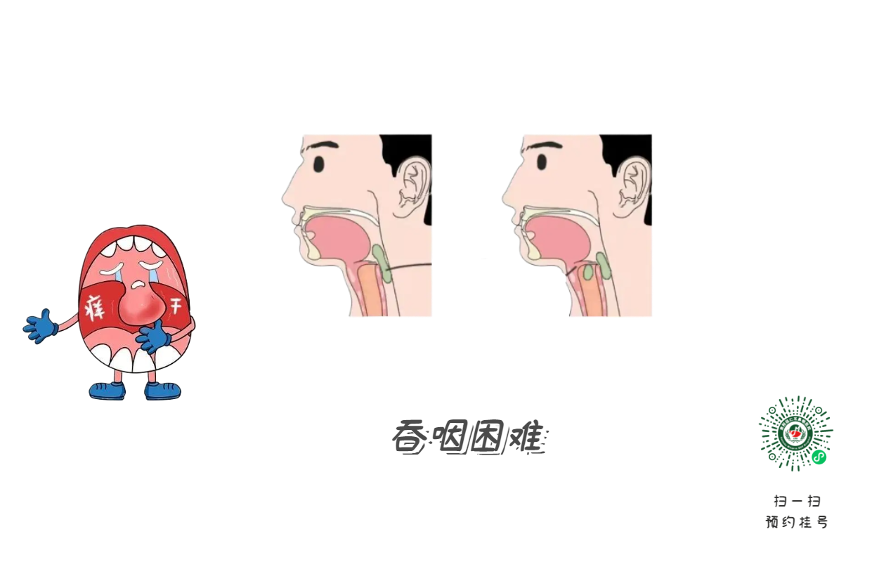 嗓子啞了別大意，可能是聲帶在“報警”(圖2)