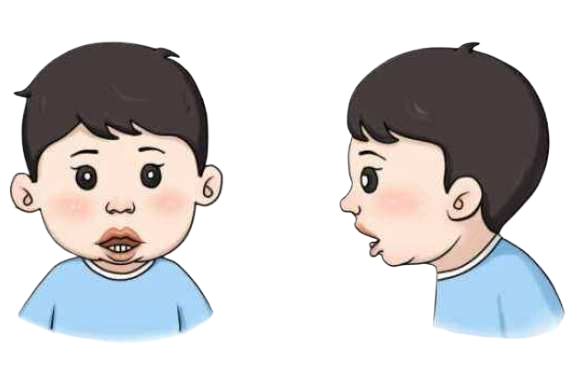 腺樣體影響智力？研究結(jié)果嚇壞家長(zhǎng)(圖2)